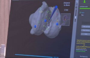Salud de rodilla vinculada al estilo de vida, dice el experto local