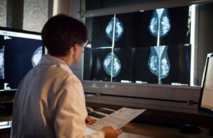 La IA ayuda a los radiólogos a detectar el cáncer de mama en pruebas del mundo real