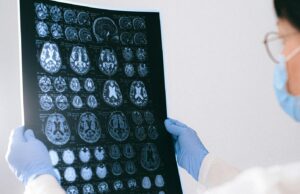 La dieta y el estilo de vida influyen en las posibilidades de sufrir trastornos cerebrales relacionados con la edad: estudio | Salud