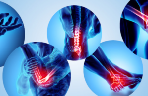 Impacto de la intervención en línea en el estilo de vida en pacientes con enfermedades reumáticas y musculoesqueléticas