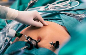 La intervención ESG Plus en el estilo de vida es prometedora para MASH