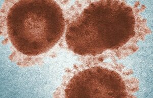 Los expertos comparten cómo Covid-19 cambió nuestro mundo 5 años después