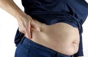 Sobrepeso, la obesidad no es una condición inofensiva de estilo de vida: expertos