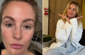 Millie Mackintosh se fue necesitando cirugía después de sufrir lesiones desagradables en casa