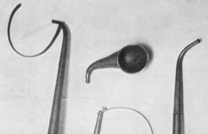 Es el día de la audición mundial: lo que debes saber