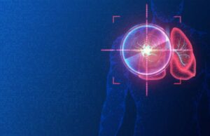 ¿Es el cáncer una enfermedad de estilo de vida? Hábitos cotidianos que podrían estar afectando su salud