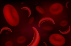 Pionero en la primera medicina CRISPR del mundo para la enfermedad de las células falciformes