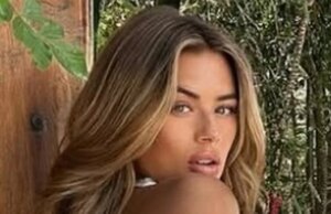 La embarazada Arabella Chi se preocupa por el golpe de quemado solar mientras defiende la decisión de volar