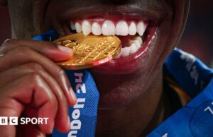 Las tres cuartas partes de los futbolistas jóvenes tienen enfermedad de las encías – estudio