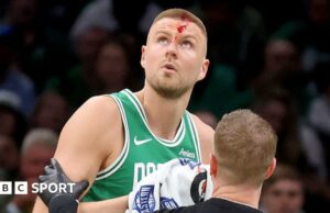 Play-offs de la NBA: Kristaps de Boston Celtics Porzingis sufre una herida en la cabeza en victoria sobre Orlando Magic