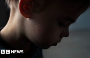 Niño maltratado que “no quería ver el mundo” se quedó ciego